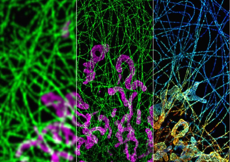 [SMLM] Super-resolution image (TOM20 & DM1α)