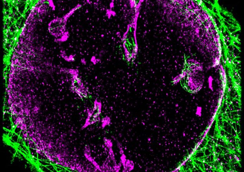 [SMLM] Heart-shaped nucleus.. Is it in love?